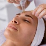 Microneedling